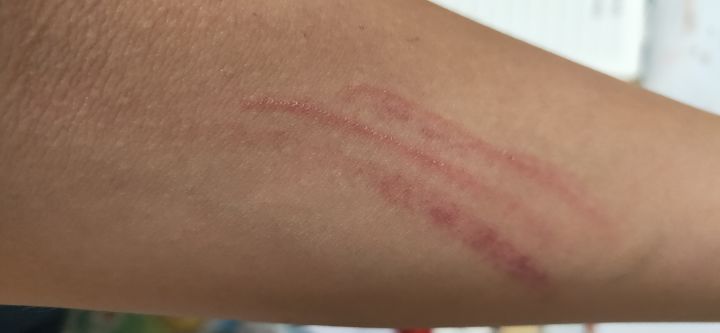 跟同学打了一架,我怀疑他是属猫的截图