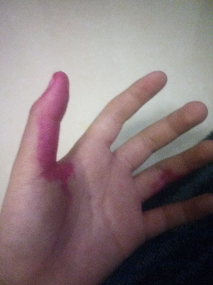 完了，火龙果吃人了截图