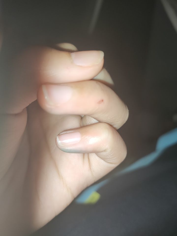 前几天被手机壳弄得🌚💦我感觉可以吹一年截图
