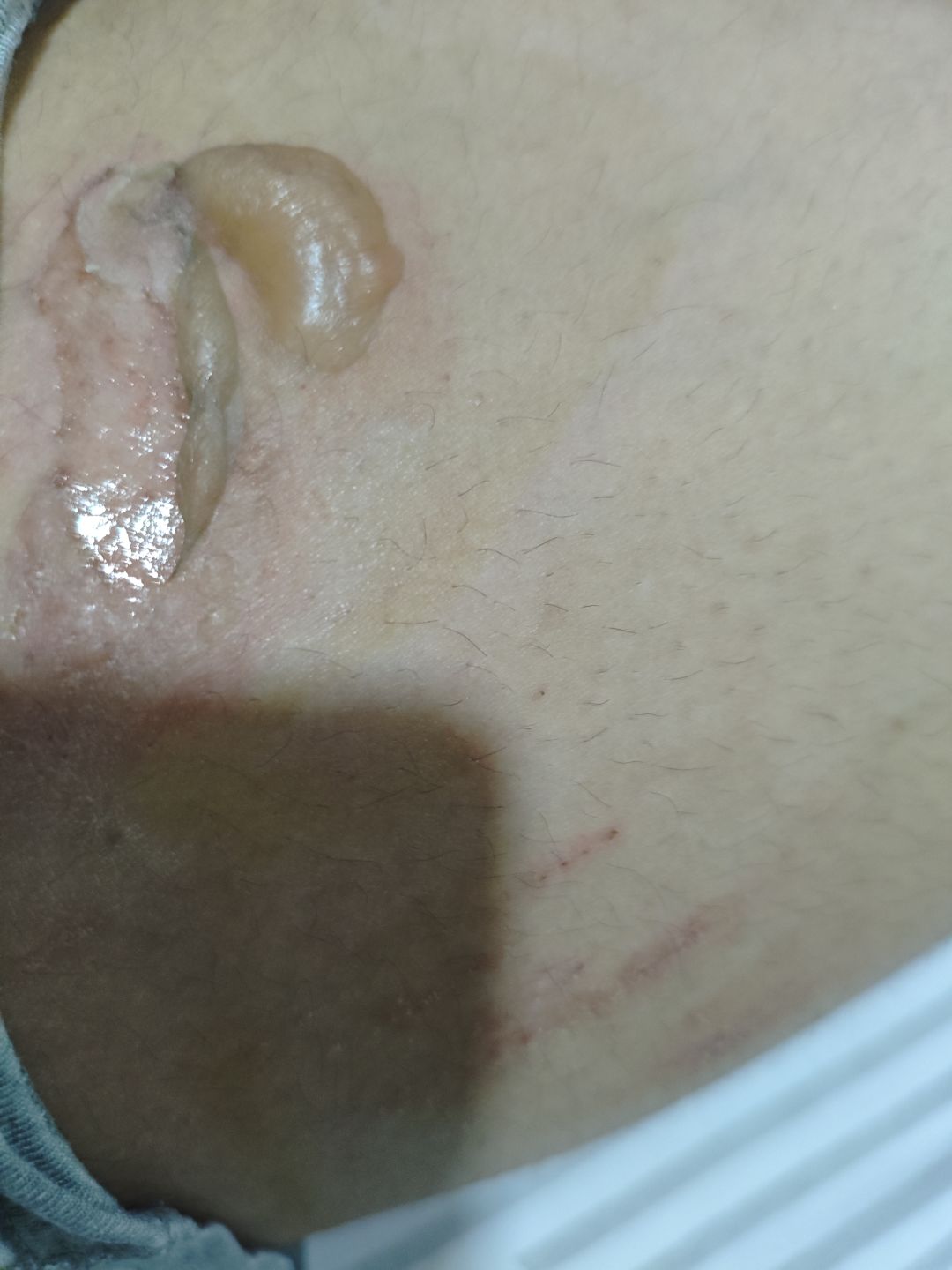运气爆棚 2