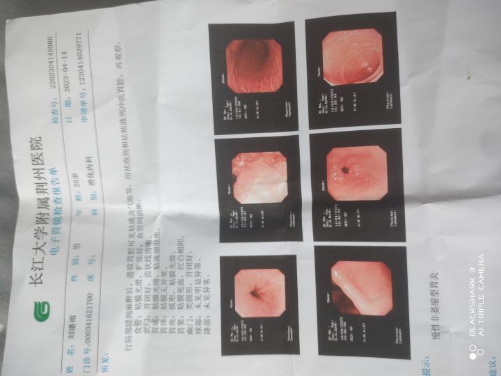 生活写照互赞截图