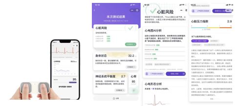 基于自研心电芯片国产化手持单导/6导/12导心电仪解决方案截图