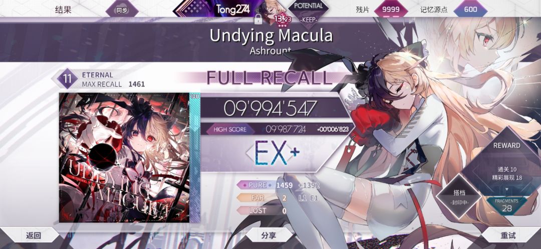 undying macula 2far 1
