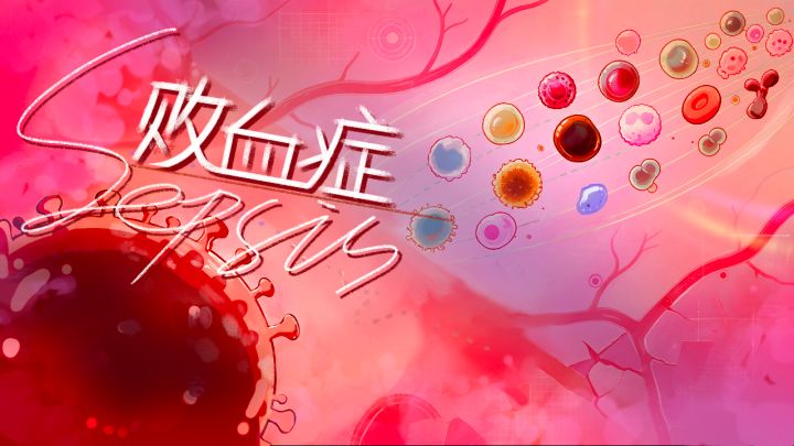 Sepsis：败血症截图