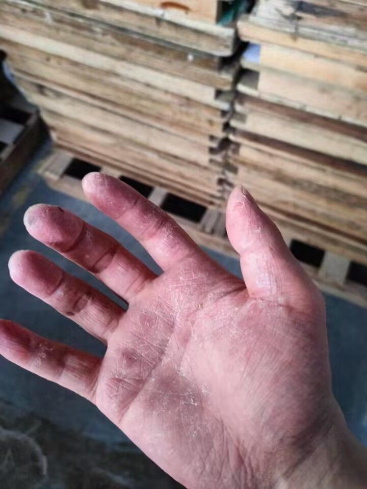 打暑假工手都磨烂了 2