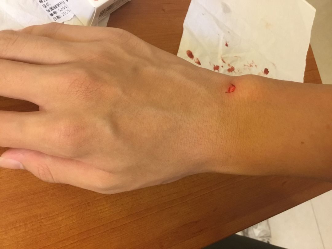 坏了给我皮刮掉一块(战绩可查,看完3张图 3
