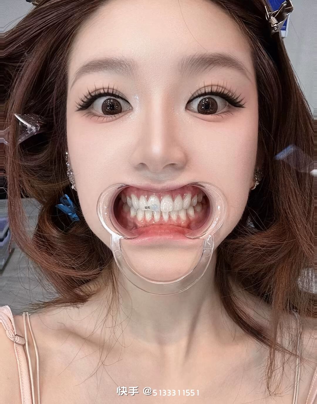 动态图片 7