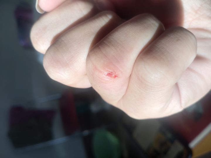 逐渐暴躁截图
