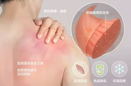 人体工学椅哪个牌子性价比高?人体工学椅口碑最好的品牌曝光截图