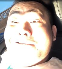 关爱帕金森患者，让世界充满爱！