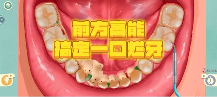 一口烂牙?一口好牙!速来搞定截图