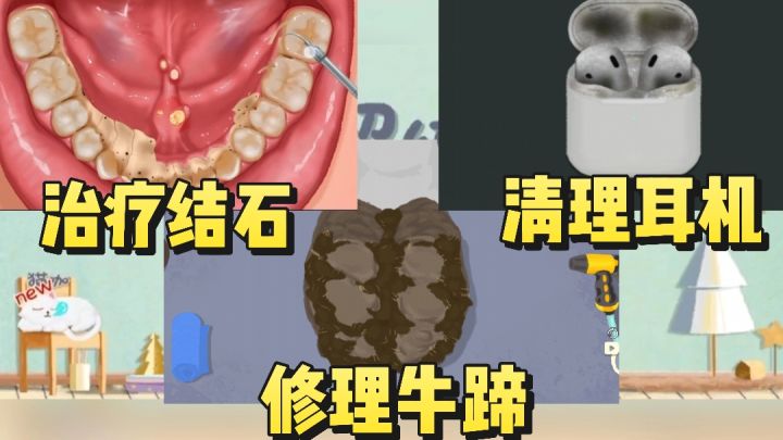 治疗结石❗️修理牛蹄❗️清理八百年的耳机壳❗️手机清洗中❗️截图