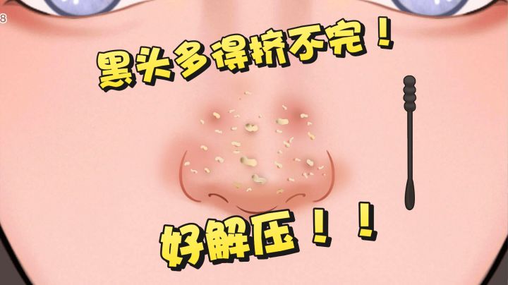 玩到超解压挤黑头游戏!!截图