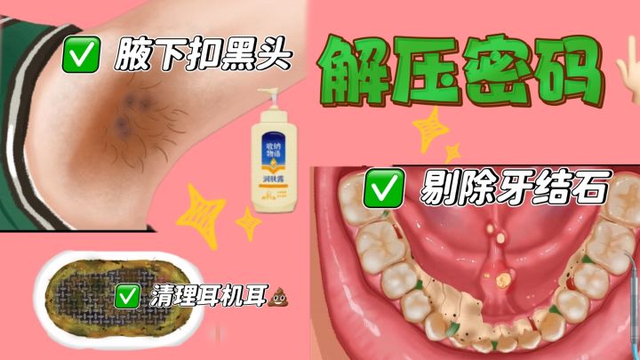 “口腔地狱模式”——牙结石?夹!舌苔?刮!扁桃体结石?挖!截图