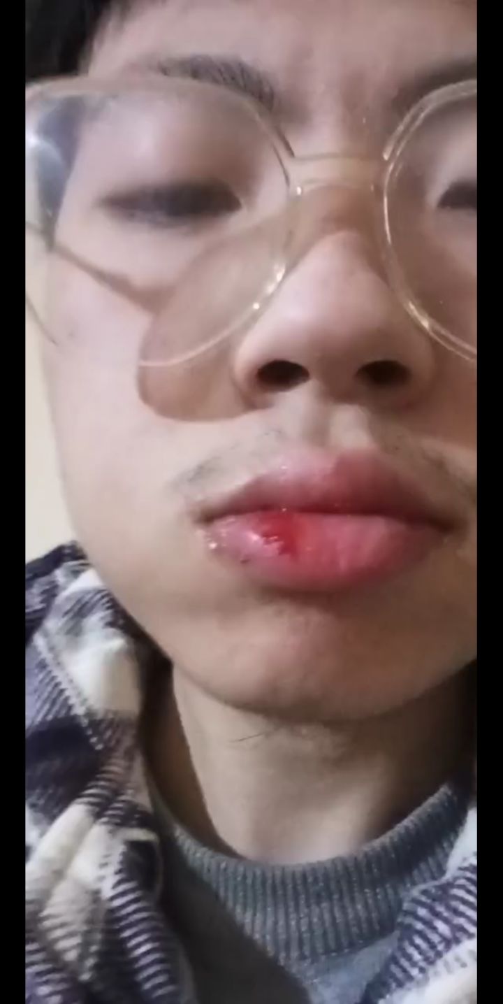 见过吃饭咬舌头 见过咬嘴唇的吗 炉石。生活截图